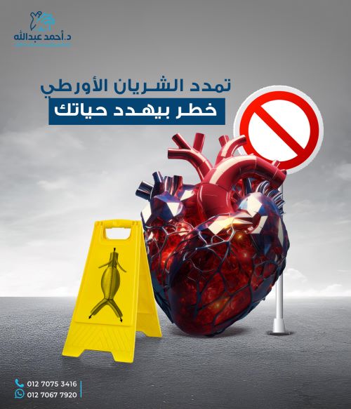 تمدد الشريان الأورطي البطني